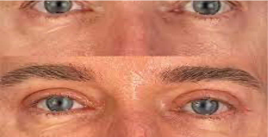 Image2 femme symbolisant l'intimité féminine et la médecine esthétique intime